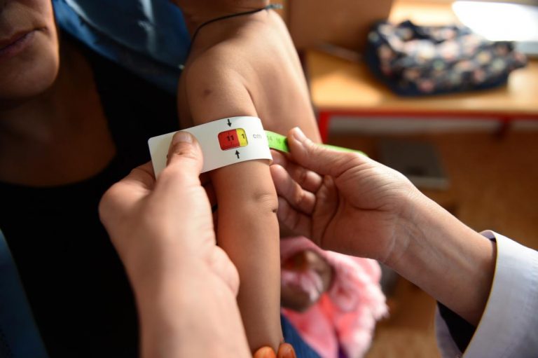 UNICEF: Cần gấp 7 triệu USD để cứu hàng trăm trẻ suy dinh dưỡng Afghanistan