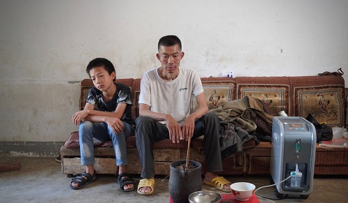 Những cái chết ám ảnh vì bụi phổi ở “làng góa phụ”