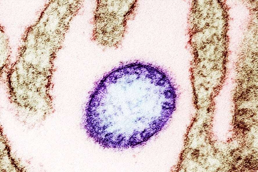 Ấn Độ phát hiện một trong những virus nguy hiểm nhất thế giới