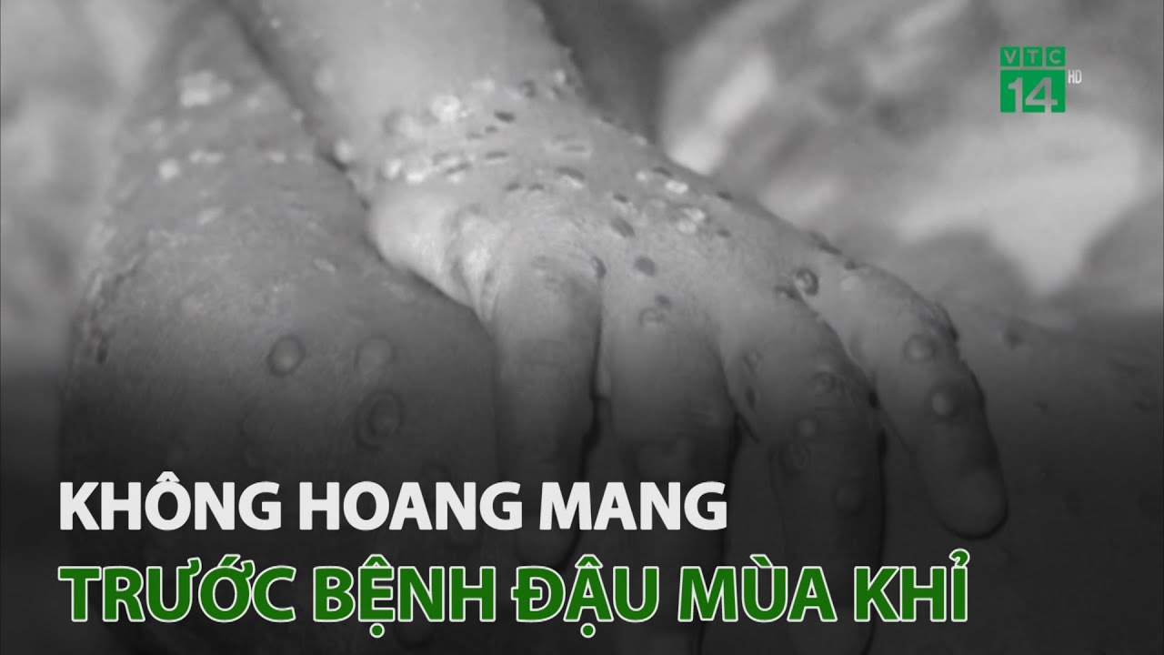 Không hoang mang trước bệnh đậu mùa khỉ