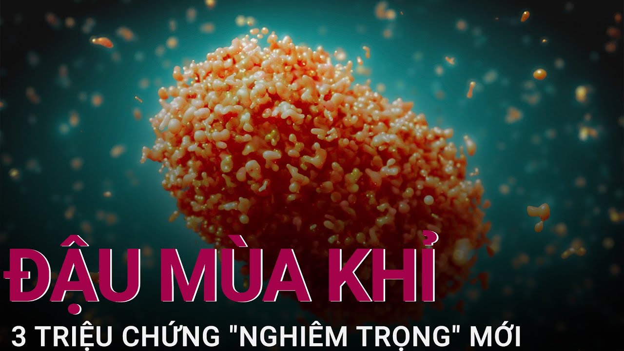 Đậu mùa khỉ: 3 triệu chứng “nghiêm trọng” mới phát hiện